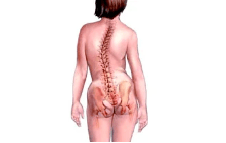 Reasons for the development of cervical osteochondrosis