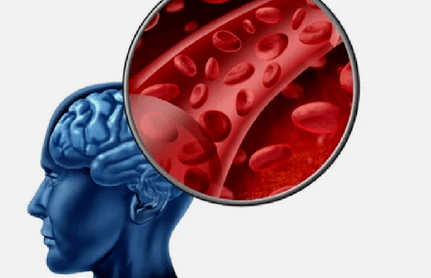 Symptoms of the osteocondrosis of cervical waist