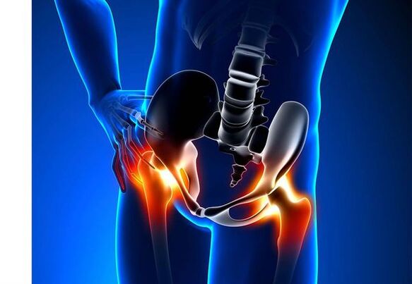 Pain for Kokesarthrosis