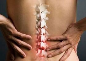 What is the difference between spinal arthrosis and arthritis