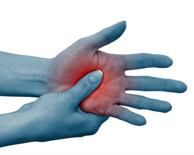 Severe pain in the joints of the fingers, which is relieved by exercise, is a typical symptom of rheumatoid arthritis. 